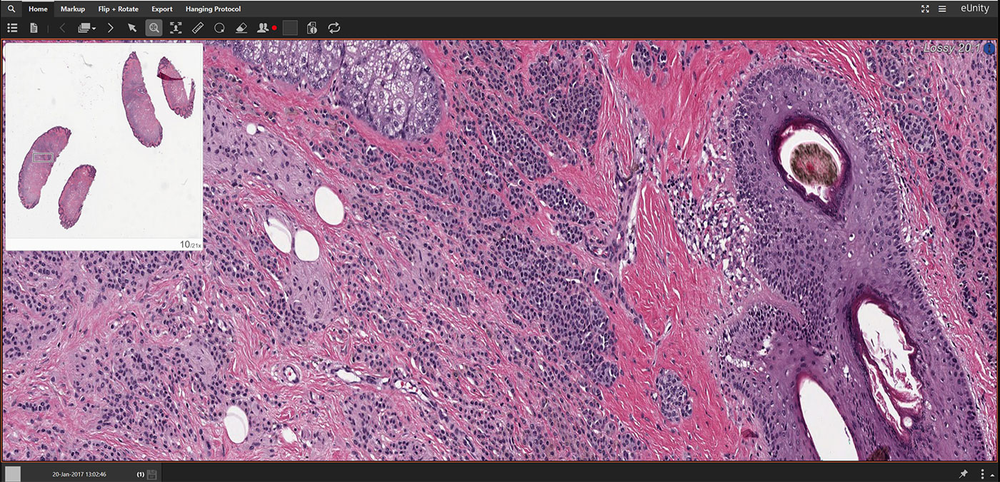 digital pathology scan